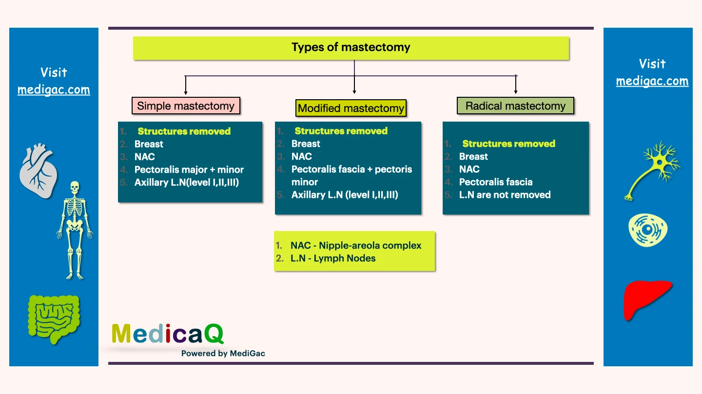 Mastectomy types - Simple, Modified and radical
